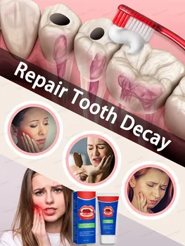 Anti Decay паста за зъби Стоматологичен крем за ремонт на кариес Предотвратяване на кариес Защита на зъбите 30g